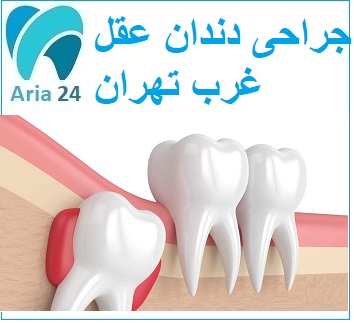 بهترین جراح دندان عقل در غرب تهران 